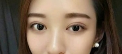 超 声 波双眼 皮,做双眼 皮美女 超 声 波双眼 皮,做双眼 皮美女