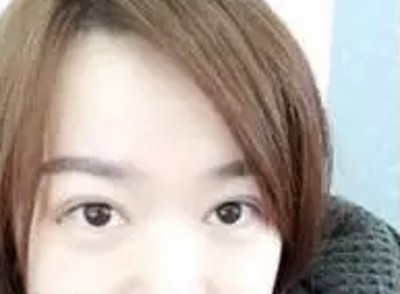 超声波双眼皮,感受青春的美好742 超声波双眼皮,感受青春的美好742