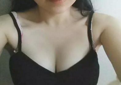 超声波自体脂肪丰胸3个月了,和真实的一样798 超声波自体脂肪丰胸3个月了,和真实的一样798