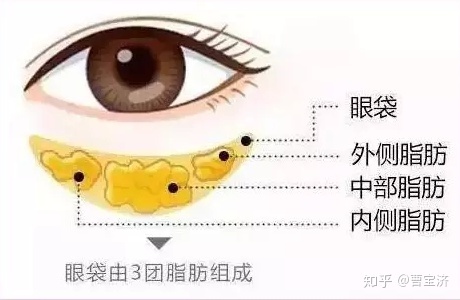 做超 声 波去眼袋手术需要注意什么 做超 声 波去眼袋手术需要注意什么