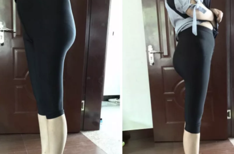 说说我做超声波减肥的真实经历吧049 说说我做超声波减肥的真实经历吧049
