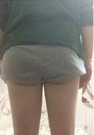 瘦大腿得看过来,wǒ介绍超 声 波减肥效果 瘦大腿得看过来,wǒ介绍超 声 波减肥效果