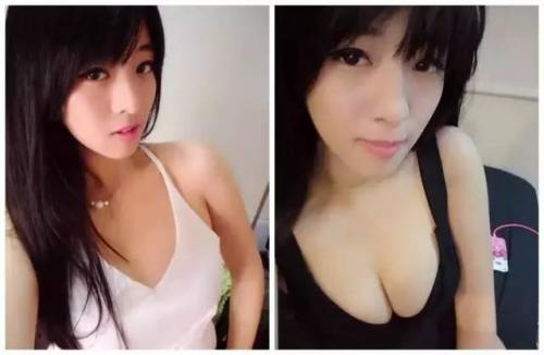 全面le解超 声 波自体脂肪丰胸手术 全面le解超 声 波自体脂肪丰胸手术