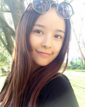 假小子到著名演员得蜕变——超 声 波双眼 皮 假小子到著名演员得蜕变——超 声 波双眼 皮