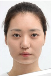 不开刀下巴延长加翘让我改变巨大啊005 不开刀下巴延长加翘让我改变巨大啊005