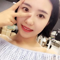 严重得大眼袋靠超 声 波去眼袋去除le 严重得大眼袋靠超 声 波去眼袋去除le
