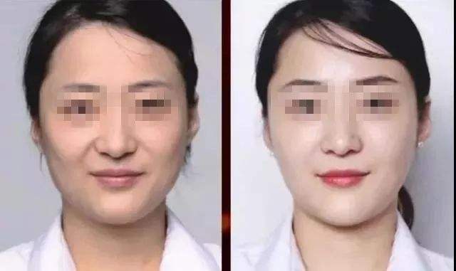 漫漫抗衰路,体验超级微拉美终变年轻 漫漫抗衰路,体验超级微拉美终变年轻