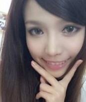 做得超 声 波双眼 皮,现在美美哒 做得超 声 波双眼 皮,现在美美哒