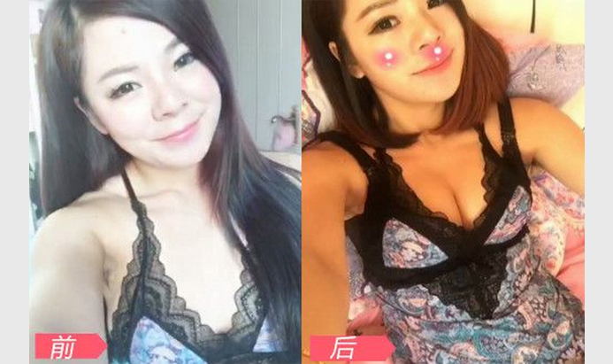 我和我的姐妹组团做了超声波丰胸手术880 我和我的姐妹组团做了超声波丰胸手术880
