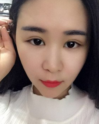 告诉你们我漂亮双眼皮的秘密617 告诉你们我漂亮双眼皮的秘密617