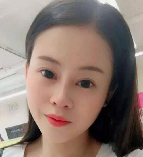 如何变成双眼皮？122