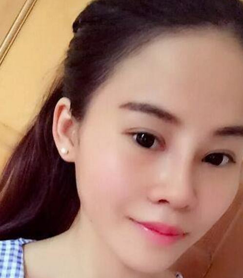 如何变成双眼皮？122