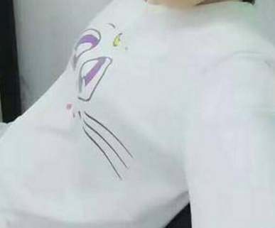 乳房小而扁平,我用的超声波自体脂肪丰胸527 乳房小而扁平,我用的超声波自体脂肪丰胸527