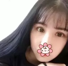 超声波双眼皮后整个人看上去都与众不同了!389 超声波双眼皮后整个人看上去都与众不同了!389