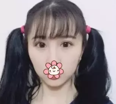 超声波双眼皮后整个人看上去都与众不同了!389 超声波双眼皮后整个人看上去都与众不同了!389