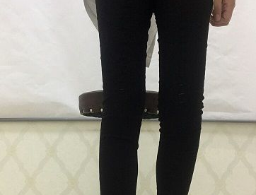 超 声 波减肥瘦大腿效果怎么样？分享图片！
