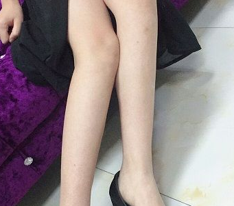 超 声 波减肥瘦大腿效果怎么样？分享图片！