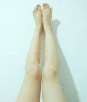 超 声 波减肥瘦大腿效果怎么样？分享图片！