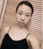 超 声 波自体脂肪丰胸3个月le,该展示效果le 超 声 波自体脂肪丰胸3个月le,该展示效果le