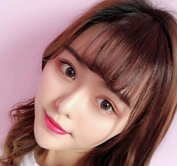 最惊艳的超声波双眼皮案例256 最惊艳的超声波双眼皮案例256
