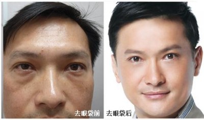 没眼袋的我才是最帅气的我312 没眼袋的我才是最帅气的我312