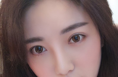 超 声 波双眼 皮著名演员也需要 超 声 波双眼 皮著名演员也需要