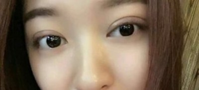 告别了眼袋感觉一身轻926 告别了眼袋感觉一身轻926