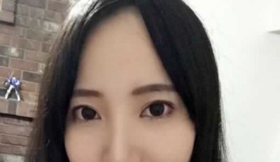 告别了眼袋感觉一身轻926 告别了眼袋感觉一身轻926