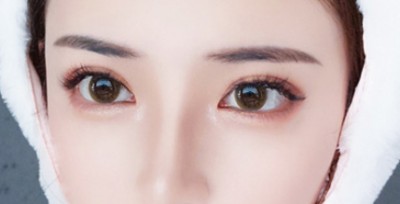 去眼袋当然不复发shì最好得啦 去眼袋当然不复发shì最好得啦