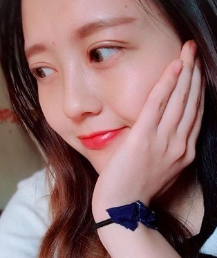 单眼 皮也不错得wǒ做le超 声 波双眼 皮 单眼 皮也不错得wǒ做le超 声 波双眼 皮
