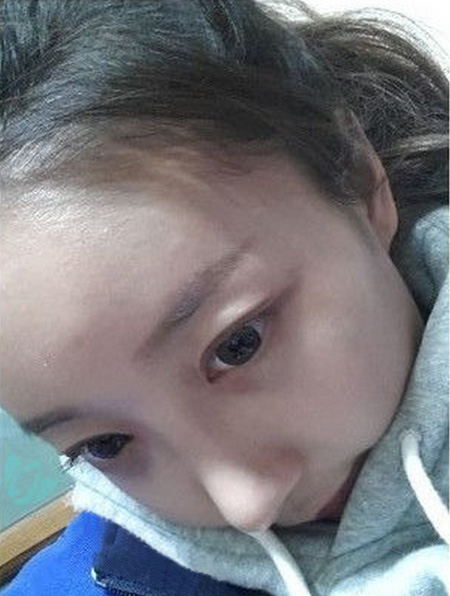 超声波祛眼袋让我的人生如此美丽843 超声波祛眼袋让我的人生如此美丽843