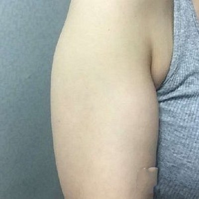 超 声 波减肥让你再也不用做麒麟臂、水桶腰、大肚子！