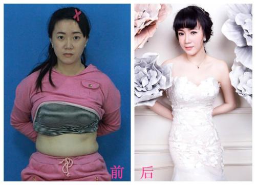 我朋友采用的超声法减肥很不错289 我朋友采用的超声法减肥很不错289
