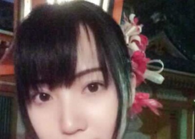 超声波双眼皮,做一个幸福的女人815 超声波双眼皮,做一个幸福的女人815