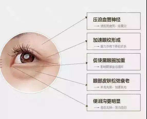 超 声 波去眼袋给你专业得眼袋治疗! 超 声 波去眼袋给你专业得眼袋治疗!
