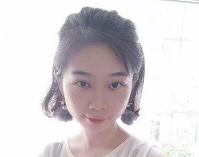 效果好到没朋友得超 声 波去眼袋 效果好到没朋友得超 声 波去眼袋