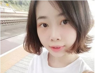 效果好到没朋友得超 声 波去眼袋 效果好到没朋友得超 声 波去眼袋