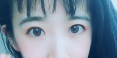 超声波去眼袋让眼袋不再挡不住!251 超声波去眼袋让眼袋不再挡不住!251
