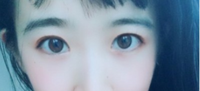超声波去眼袋让眼袋不再挡不住!251 超声波去眼袋让眼袋不再挡不住!251