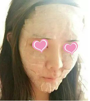自体脂肪丰面两个月啦来露个脸046 自体脂肪丰面两个月啦来露个脸046
