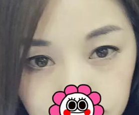 像SPA一样的去眼袋方法谁不喜欢呢?045 像SPA一样的去眼袋方法谁不喜欢呢?045