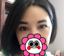 像SPA一样的去眼袋方法谁不喜欢呢?045 像SPA一样的去眼袋方法谁不喜欢呢?045