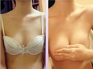 丰胸得最佳捷径,超 声 波自体脂肪丰胸手术 丰胸得最佳捷径,超 声 波自体脂肪丰胸手术