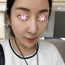 做了超级微拉美,效果被折服了!935 做了超级微拉美,效果被折服了!935