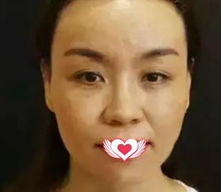 超级微拉美后面部如20岁般紧致嫩滑 超级微拉美后面部如20岁般紧致嫩滑