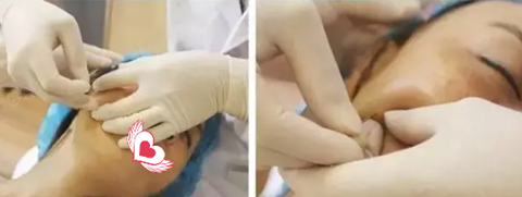 超级微拉美后面部如20岁般紧致嫩滑 超级微拉美后面部如20岁般紧致嫩滑