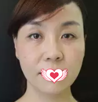 超级微拉美后面部如20岁般紧致嫩滑 超级微拉美后面部如20岁般紧致嫩滑