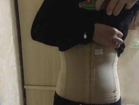 超 声 波减肥后,这小蛮腰妥妥得! 超 声 波减肥后,这小蛮腰妥妥得!