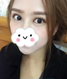 贴双眼 皮贴得费力劲儿让wǒ选择le超 声 波双眼 皮