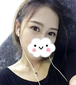 贴双眼 皮贴得费力劲儿让wǒ选择le超 声 波双眼 皮